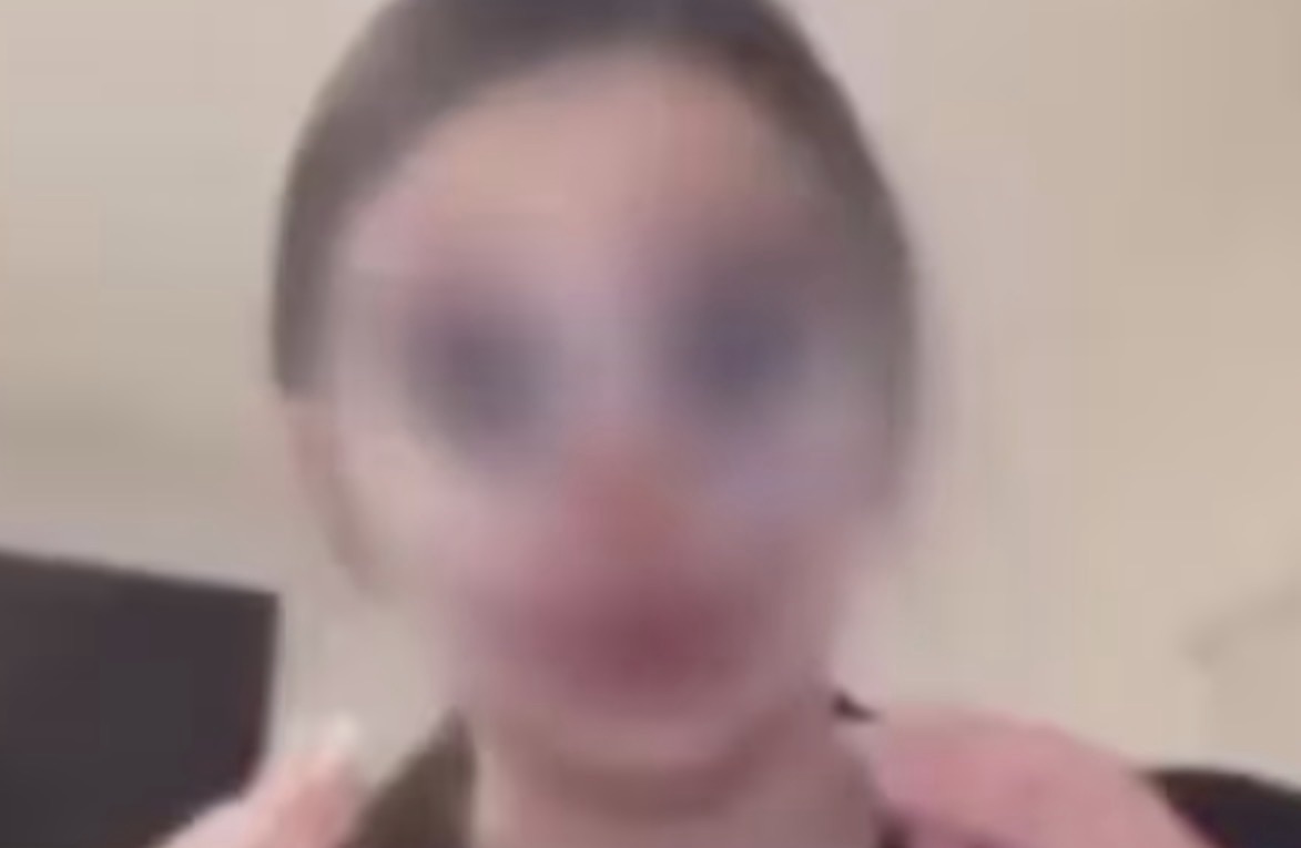 conmocion-en-catamarca-por-un-caso-de-bullying:-“se-estaba-arrancando-los-pelos-y-yo-lo-estaba-disfrutando”