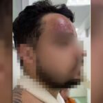 assessor-de-jair-renan-bolsonaro-e-investigado-por-agredir-primo-apos-eleicoes-em-sc