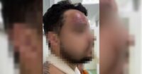 assessor-de-jair-renan-bolsonaro-e-investigado-por-agredir-primo-apos-eleicoes-em-sc