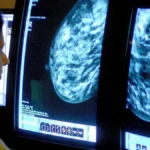 mamografias-sin-costo-de-ticket-desde-los-40-anos-y-cambia-los-criterios-para-el-papanicolau