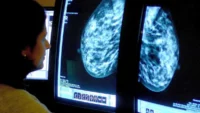 mamografias-sin-costo-de-ticket-desde-los-40-anos-y-cambia-los-criterios-para-el-papanicolau